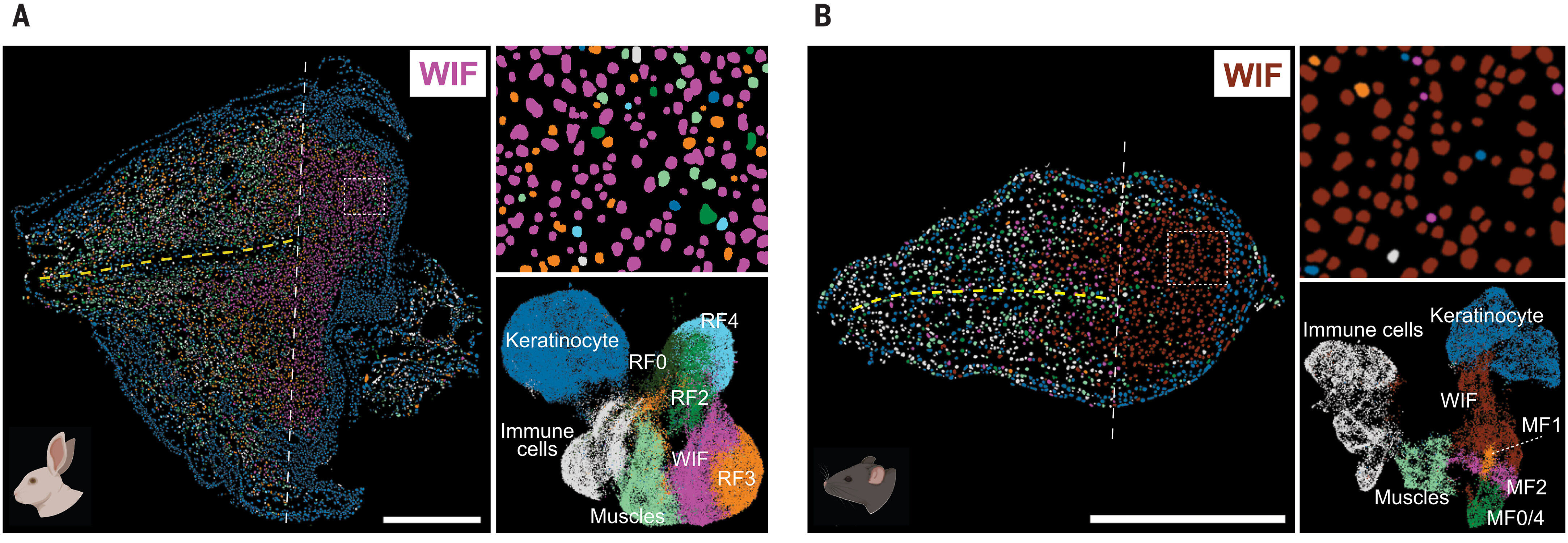Figure 1. Mapping the Spatial Architecture of Fibrosis